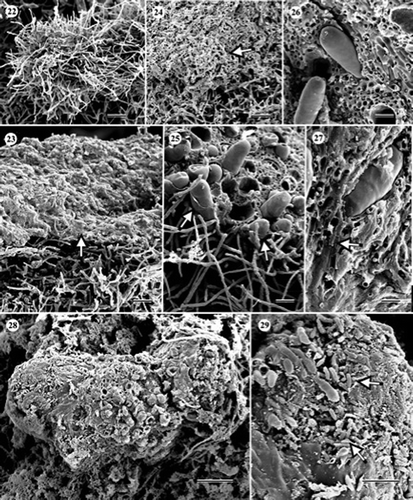 Figures 22–29. Scanning electron micrographs of Cryptosporiopsis grisea (UAMH 10860, CBS 482.97) on CMA after 3 months at 22 °C. (22) Conidiomatal initial. (23) Immature conidioma with a developing conidiogenous layer embedded in adhesive amorphous material (arrow). (24) Obliquely fractured immature conidiogenous layer showing sterile stromatic tissue (arrow). (25)–(27) Obliquely fractured mature conidiogenous layer showing macroconidia arising from the stromatic tissue. Arrows in Figure 25 indicate macroconidia-bearing remnants of amorphous material. The arrow in Figure 27 indicates macroconidiogenous cell. (28) Top view of a mature conidioma. (29) Macro- and micro-conidia (arrows). Bars = 25 μm (Figure 22); 17 μm (Figure 23); 20 μm (Figure 24); 12 μm (Figures 25 and 29); 6 μm (Figures 26 and 27); 30 μm (Figure 28).