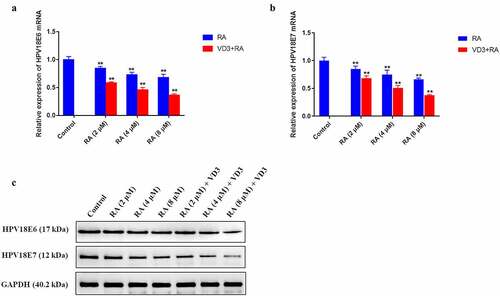 Figure 4. The effect of RA and RA with the addition of 100 nM/L VD3 on HPV18E6 and HPV18E7 expression in HeLa cells. (a, b) Expression of HPV18E6 and HPV18E7 in each sample was normalized to that of GAPDH. Data was presented as mean ± SD of three independent experiments. ** P < 0.01 versus the control groups (0 μM/L RA and 0 μM/L VD3). (c) The protein alterations of HPV18E6 and HPV18E7 were examined by Western blotting. RA: Raddeanin A; RA+VD3: Raddeanin A combined with 100 nM/L VD3.