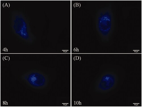 Figure 8. Fluorescence microscopy images of HepG-2 cells incubated with HA-ss-ATRA/TPENH2 HNPs for 4 h(A), 6 h(B), 8 h(C) and 10 h(D). Scale bars correspond to 10 μm in all the images.
