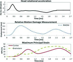 Fig. 3. Head rotational acceleration (top), average RMDM (middle), and MPS from representative elements of the brain cortex and the brainstem (bottom) obtained in the simulated rotational trauma with the young adult model.