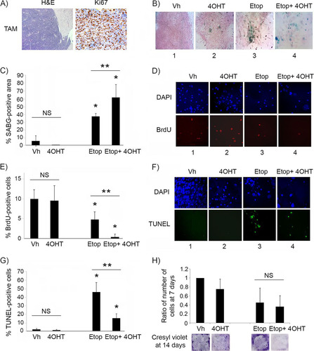 FIG 3 p53 restoration is not effective in suppressing proliferation of malignant pineal tumor cells unless combined with genotoxic stress. (A) Representative hematoxylin and eosin staining (H&E) and Ki67 immunostaining in Irbp-Cyclin D1, p53ER(TAM)Ki/− pineal tumors after 6 days of treatment with tamoxifen (TAM) to restore p53. (B) Representative staining for SABG in explanted Irbp-Cyclin D1, p53ERTAMKi/− pineal tumor cells treated for 7 days with vehicle (Vh), 4OHT to restore p53, etoposide to induce genotoxic stress (Etop), or etoposide and 4OHT (Etop + 4OHT), as indicated. (C) Percent SABG-positive area under the conditions described for panel B, where area was measured in pixel density as explained in Materials and Methods. (D) Representative BrdU level and corresponding DAPI nuclear staining under the same conditions as those for panel B. (E) Percent BrdU-positive cells for the conditions depicted in panel D. (F) Representative TUNEL staining to detect apoptosis, under the same conditions as those for panel B, at 48 h after treatment. (G) Percent TUNEL-positive cells under the same conditions as those for panel F. (H, upper) Quantitation of the total number of cells under the conditions described for panel B at 7 days after treatment and normalized to the vehicle-treated control. (Lower) Cresyl violet stain for colony formation assay under the same conditions at 14 days after treatment. Each point in panels C, E, G, and H represents the means from at least 5 fields and is representative of at least 2 independent experiments. Bars represent standard deviations, asterisks denote a statistically significant difference (P < 0.05), and NS denotes nonsignificant difference. A single asterisk denotes significance relative to corresponding control conditions (Vh and 4OHT, respectively), while double asterisks denote significance relative to Etop-treated cells, as shown by the horizontal bar.