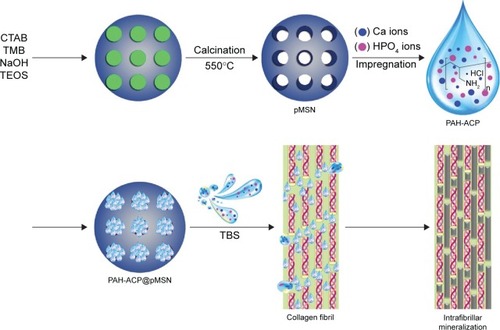Figure 7 Schematic summarizing the development of a biodegradable mesoporous carrier for the delivery of ACP mineralization precursors.Abbreviations: CTAB, cetyltrimethylammonium bromide; NaOH, sodium hydroxide; PAH-ACP, poly(allylamine)-stabilized amorphous calcium phosphate; PAH-ACP@ pMSN, PAH-ACP loaded pMSN; pMSN, expanded-pore mesoporous silica nanoparticles; TBS, tris(hydroxymethyl)aminomethane-buffered saline; TEOS, tetraethyl orthosilicate; TMB, 1,3,5-trime thylbenzene.