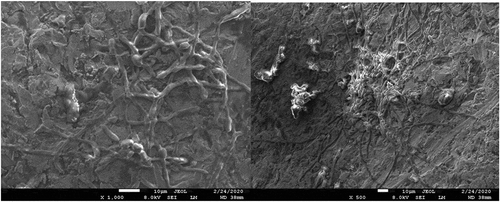 Figure 7. (a), (b). Scanning electron microscopic image showing biofilm of C. albicans.