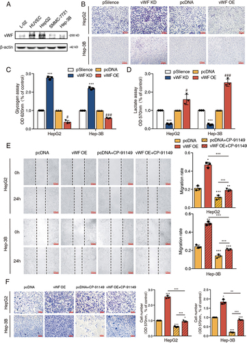 Figure 1 vWF derived from HCC cells promotes tumor migration through inducing glycolysis in vitro. (A) The expression levels of vWF in L-02, HUVEC and HCC cell lines. (B–D) PAS staining, glycogen and L-lactate content of vWF overexpression and knockdown HCC cells. ***P<0.001, compared with vWF psilence group; #P<0.05, ###P<0.001, compared with vWF pcDNA group. (E and F) Wound-healing and Transwell assays revealed the migration ability of HCC cells under the treatment of vWF OE and 0.5 μM CP-91149.