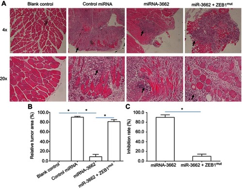 Figure 8 miR-3662 inhibits the invasive growth of A375 in the muscle tissue of nude mice. A375 cells transfected with control miRNA, miR-3662, or miR-3662+ ZEB1Mut were seeded into the muscle tissue of nude mice. (A) Representative image of H&E stained muscle tissue with tumor-tissue formed by A375 cells, (B) relative invasive growth of A375 cells, (C) inhibition rates calculated from the relative invasive growth of A375 cells. The black arrows indicate the tumor lesions in muscle tissues formed by A375 cells. *P<0.05.