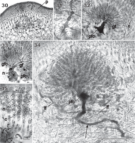 Figs 30–35 Chondrymenia lobata. Stages of gonimoblast and associated placental gametophyte development (Figs 30, 31, 34, 35: HGI-A 6905; Fig. 32: HGI-A 6960; Fig. 33: HGI-A 8384). Figs 30, 31, aniline-blue stained; Figs 32–35, haematoxylin stained. 30. Placental network of interconnected gametophytic filaments presumed to be associated with nearby gonimoblast formation, surrounded by a thick pericarp (p). 31. Enlarged cells with dense contents within the placental network. 32. Fusion of placental filaments with the auxiliary cell to produce a placental fusion cell (pfc) from which the gonimoblast filaments (gf) arise. 33. Gonimoblast filaments (gf) radiating towards the thallus surface from a gonimoblast fusion cell (gfc) that has fused onto the placental fusion cell (pfc). 34. Elongation of the placental fusion cell (arrow) through the apparent incorporation of cell lineages that originally bore the supporting cell. See also the two opposite lateral filaments (lf) originally cut off from the auxiliary cell, and the fusion of medullary cells belonging to the same branch lineage to form a long tubular ‘root’ that extends deep into the medulla (arrow). 35. Enlarged view of chains of uninucleate (n) carposporangia (c). Scale bars = 100 µm (Fig. 30), 20 µm (Figs 31–33, 35) and 50 µm (Fig. 34).