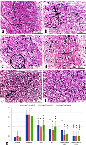 Figure 7. (a-f): Photomicrograph (H&E) of the substantia nigra region of (a) control mice displaying normal dopaminergic neuronal cells (N) with vesicular nuclei and lightly stained cytoplasm in a healthy neuropil, (b) Induced parkinsonism group showing numerous dark pyknotic neurons in the vicinity of infiltrated glial cells (circle), interstitial edema (E). Areas of marked neuronal loss in highly vacuolated neuropil are also observed (v), (c) L-dopa group displaying few Lewy body inclusions (L) and marked glial cell infiltration surrounding the degenerated dopaminergic neurons (circle), (d) MSCs group showing improvement in the neuronal architecture but with residual peri-neuronal halos (H) and Lewy’s inclusions (L), (e) EPO-activated MSCs group showing several intact neurons with only a few degenerated ones with karyolitic nuclei (curved arrows), (f) Laser-activated MSCs group exhibiting numerous neurons with preserved structure in intact neuropil akin to the control group. (g) Scoring of astrogliosis, neuronal vascuolation and microgliosis in the different study groups at (P < 0.05) using ANOVA, Bonferroni post hoc testing. Values are presented as mean ± SD. *: significant versus control, #: significant versus PD, $: significant versus L-dopa, @: significant versus MSCs (P < 0.05), &: significant versus EPO-activated MSCs (n = 8).