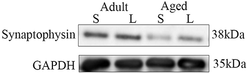 Figure 2 Western blotting analysis of synaptophysin expression in the adult + leptin group, adult + saline group, aged + leptin group and aged + saline group.