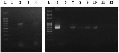 Figure 2. Amplification of AMPR gene fragment from different Nannochloropsis sp. transgenic lines genome. Lanes L represent 100bp ladder. Lane 1 represents Wild type. Lane 2 represents circular pUC19 (Electroporation). Lane 4 represents circular pGEM-T (Electroporation). Lane 5 represents Positive control (vector). Lane 6 represents Wild type. Lane 7 represents linear pGEM-T (Electroporation). Lane 8 represents linear pGEM-T (Enzyme-treated cells + Electroporation). Lane 9 represents linear pUC19 (Electroporation). Lane 10 represents linear pUC19 (Enzyme-treated cells + Electroporation). Lane 11 represents PCR fragment (Electroporation). Lane 12 represents PCR fragment (Enzyme-treated cells + Electroporation).