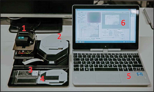 Figure 1. MoMic digital microscope scanner (1) with external motor unit attached (2). The microscope glass (3) is placed in the slide holder (4), which is placed in the microscope and navigated from the motor unit. The device is connected to and operated from a laptop computer (5) running software (6) for operation of the device.