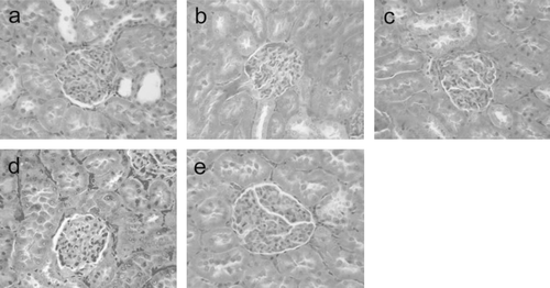 Figure 6.  Histology of renal glomeruli in rats toploading with NanoRBC (a), LactRing (b), SFHb (c), PolyHb (d) or RBC (e). Under light microscope, the renal glomeruli in rats of all groups did not show abnormality with normal number of renal glomeruli, no glomerular necrosis, distention or degeneration. H&E staining, ×400.