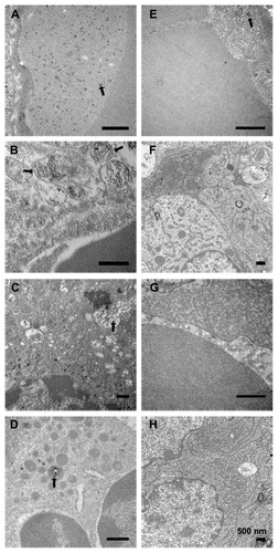 Figure 6 Representative TEM of tumors in mice treated with anti-VEGF-NPs or NPs. On day 1 after nanoparticle injection, the tumors were fixed with paraformaldehyde, incubated with osmium tetroxide, and embedded in epoxy resin. Thin sections were stained lightly with uranyl acetate and lead citrate to detect uptake of nanoparticles into the cells. (A–D) Anti-VEGF-NPs were present in the vascular lumen (A), endothelial cells and the matrix of surrounding capillaries (B), and tumor cells (C), and were trapped inside lysosomes (D). (E and F) NPs were present in the vascular lumen and the cytoplasm of endothelial cells (E), and seldom found in the extracellular matrix and tumor cells (F). (G and H) Tumor sections from mice not injected with nanoparticles. The arrows indicate the location of nanoparticles.Note: Scale bars = 500 nm.Abbreviations: TEM, transmission electron micrographs; VEGF-NPs, vascular endothelial growth factor; NPs, nanoparticles.