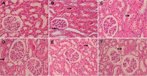 Figure 4 Representative micrographs of kidney tissue stained with hematoxylin–eosin.