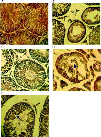 Figure 3.  Microphotogram from rat testes. A) control-sham group: the seminiferous tubules with positive tubular differentation and spermiogenesis indexes (SP) with no edema in connective tissue are observed; B) varicocele-induced non-treated group: seminiferous tubules are presented with arrested spermatigenesis. A severe edema in connective tissue (SE) and decreased number of Leydig cells are shown; C) silymarin (SMN)-treated group: the seminiferous tubules are exhibiting normal spermatogenesis with positive tubular differentiation and spermiogenesis (SP) indices. An improved edema (IE) in connective tissue are seen; D) higher magnification from seminiferous tubules with spermatogenesis arrest (SA) on varicocelized testes: the giant cell (head arrow); and E) the tubule from varicocele-positve testes exhibites negative tubular differentiation index (TDI). The spermiogenesis from previous stages are presented with arrow. Iron-Weigert staining, A-C: 400× magnification, D-E: 600× magnification