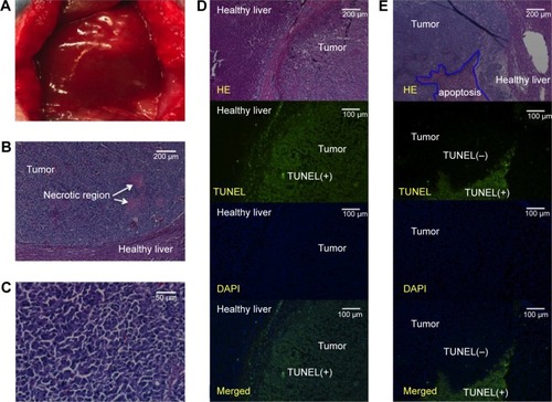 Figure 4 Images showing the tumors, histopathology, and tumor apoptosis.Notes: (A) Macroscopic image of a tumor. (B, C) Microscopic characterization of an N1-S1 hepatic tumor. Malignant cells with hyperchromatic nuclei, a high nuclear/cytoplasmic ratio, and poor differentiation, along with hypervascularization and scattered necrotic regions. (D, E) Microscopic analysis of H&E-stained tumor sections reveals two different regions: one containing typical malignant cells and the other containing disrupted cells characterized by missing nuclei, indistinct cell walls, or nuclei without surrounding cell structures. Upon collation with the observations from the fluorescent TUNEL assay, these disrupted cell regions were found to correspond with the regions with high levels of positive fluorescein-12-dUTP incorporation (TUNEL-positive regions).Abbreviations: DAPI, 4′,6-diamidino-2-phenylindole; H&E, hematoxylin and eosin; TUNEL, terminal deoxynucleotidyl transferase dUTP nick-end labeling.