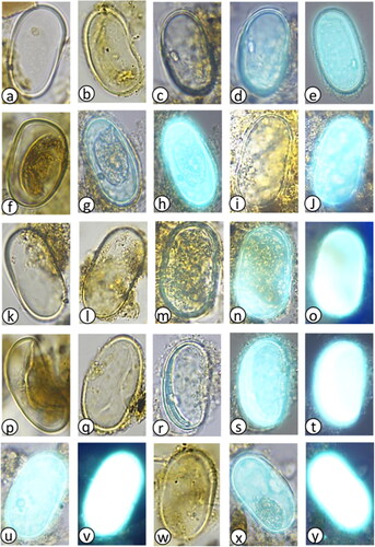 Plate 3. Inshore Alexandrium tamarense complex images captured during light microscopy and primulin staining fluorescence presented in depth of occurrence: (a–e) 1 cmbsf (1 yr), (f–j) 3 cmbsf (3 yrs), (k–o) 5 cmbsf (5 yrs), (p–t) 7 cmbsf (7 yrs), (u,v) 13 cmbsf (15 yrs), (w) 21 cmbsf (64 yrs), (x,y) 26 cmbsf (95 yrs).