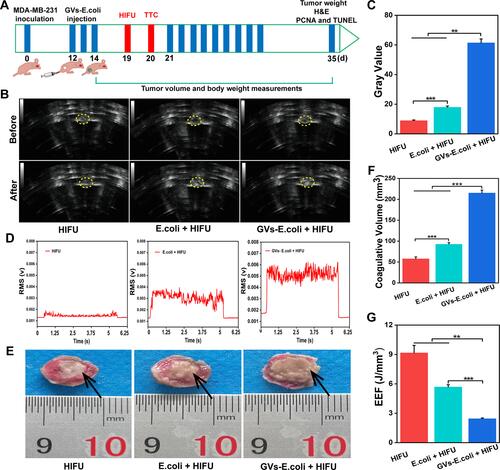 Figure 7 Synergistic effect of GVs-E. coli by HIFU ablation. (A) The schematic illustration of the treatment protocol. (B) In vivo ultrasound imaging of tumor tissues (yellow circle) before HIFU ablation and after HIFU ablation in a different group. The yellow dotted circle marks the tumor nodules. (C) The comparison of gray values of tumor tissues in each group after HIFU irradiation (n=5, **P<0.05, ***P<0.001). (D) Representative images of cavitation activity at the HIFU irradiation for PCD signals. (E) Coagulative necrosis of tumors by TTC staining after HIFU therapy, the necrotic tissue appears gray and the normal tumor tissue is red (black arrows marks the necrotic tissue). (F) The comparison of coagulative necrosis of tumor tissues in each group after HIFU irradiation (n=5, ***P<0.001). (G) The comparison of EEF of tumor tissues in each group after HIFU Irradiation (n=5, **P<0.05, ***P<0.001).