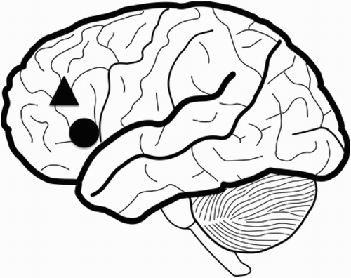 Figure 7. Broca’s area (represented by the circle) is within close proximity of the dorsolateral prefrontal cortex (represented by the triangle). Unintentional stimulation of either area may occur while attempting to use tDCS. Source: Author generated.