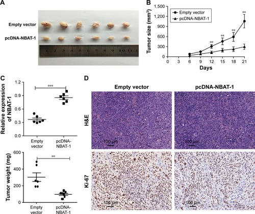 Figure 5 NBAT-1 suppresses tumor growth in vivo.
