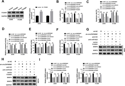 Figure 5 The effect of miR-623 and FOXM1 on circZNF609-mediated NSCLC progression. (A) FOXM1 level was detected in A549 and H1299 cells with transfection of FOXM1 overexpression vector or the empty vector. Cell viability (B), apoptotic rate (C), caspase3 activity (D), metastasis (E–F), and protein of MMP9 and MMP2 (G–I) were assessed in cells with transfection of sh-NC, sh-circZNF609#1, sh-circZNF609#1 + anti-NC, anti-miR-623, vector or FOXM1 overexpression vector. *P<0.05, **P<0.01.