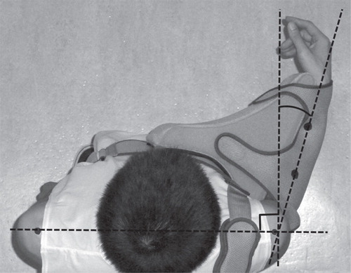 Figure 2. Measurement of the angle of external rotation. Two skin markers were placed on the central portion of the proximal and distal forearm to define the forearm axis. To draw a line perpendicular to the frontal plane of the subject, skin markers were also placed on bilateral acromio-clavicular joints.