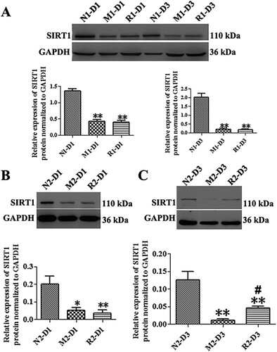 Figure 6. RSV-induced effect on SIRT1 protein expression in MNU-treated retinas. A: Representative Western blot bands and quantitative analysis of SIRT1 protein expression of retinas with RSV intervention of the first mode; B, C: Representative Western blot bands and quantitative analysis of SIRT1 protein expression of retinas with RSV intervention of the second mode at 1 d (B) and 3 d (C) after MNU administration. (n = 3; *P < 0.05, **P < 0.01: vs. N group; #P < 0.05: vs. M group).