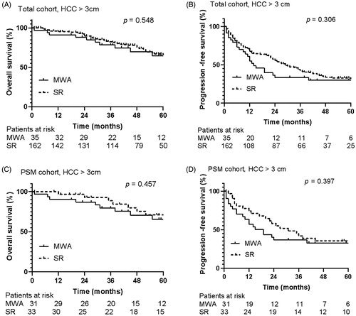 Figure 2. Overall survival and progression-free survival curves of patients with hepatocellular carcinoma ≥ 3 cm who underwent microwave ablation or resection. There were no significant differences in overall survival curves (A) and progression free survival curves (B) between MWA group and SR group in total cohort for hepatocellular carcinoma ≥ 3 cm (p = 0.548, p = 0.306). And there were no significant differences in overall survival curves (C) and progression-free survival curves (D) between MWA group and SR group in PSM cohort for hepatocellular carcinoma ≥ 3 cm (p = 0.457, p = 0.397).