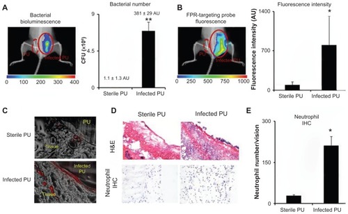 Figure 5 In an infected catheter inflammation model, polyurethane catheters were colonized with luciferase transgene Staphylococcus aureus and then transplanted subcutaneously on the back of animals for 24 hours. The animals were then administered with formyl peptide receptor-targeting nanoprobes for 3 hours prior to imaging analyses. (A) Representative bioluminescence image and the estimated bacterial colony-forming unit count depict bacterial colonization on an implanted catheter. (B) Fluorescence image and quantification of fluorescence intensity show formyl peptide receptor-targeting nanoprobe accumulation at the implantation site of infected polyurethane catheters. (C) Near-infrared fluorescence acquisition (red color) superimposed onto the correlative phase contrast microscopy image (20×) for tissues surrounding the polyurethane catheters. (D) Representative hematoxylin and eosin staining (200×) and immunohistochemical staining of neutrophils (400×) and (E) neutrophil counts support the conclusion that substantially higher numbers of neutrophils were recruited to the infected polyurethane catheters than sterile ones.Abbreviations: H&E, hematoxylin and eosin; FPR, formyl peptide receptor; IHC, immunohistochemical; PU, polyurethane.