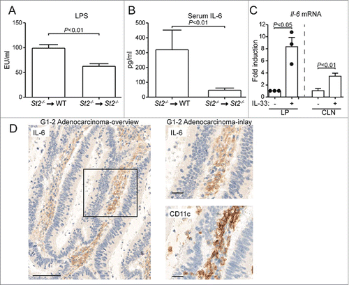 Figure 5. Engagement of the IL-33/ST2 signaling compromises the integrity of the intestinal barrier and stimulates the production of pro-tumorigenic IL-6. Indicated groups of BM chimeric mice were challenged with DSS and (A) LPS and (B) IL-6 were measured in the serum; n = 5–9 samples. (C) IL-33 stimulated Il6 expression in lamina propria (LP) and caudal lymph node (CLN) immune cells from DSS-treated WT mice. For LP, cells were pooled from 5 donors and analyzed. Three independent experiments were performed, each represented by a dot. For CLN, cells from four individual mice were analyzed. (D) Serial sections of low-grade human colonic adenocarcinomas were stained for IL-6 or CD11c. Scale bars: representative overview: 100 µm; inlay 25 µm. Data are means ± SEM and show one representative from two independent experiments. Statistical analyses were performed using Student t test (A, B) and paired Student t test (C).