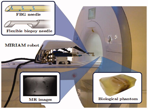 Figure 13. MRI-based FSNP equipment.