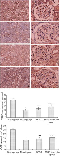 Figure 5. VEGF expression of the kidney in different groups: (A and B) sham group; (C and D) model group; (E and F) SFSG group; (G and H) SFSG + atropine group. Magnifications: ×100 in (A, C, E, and G); ×400 in (B, D, F, and H).Note: *p < 0.05 compared with sham group; **p < 0.05 compared with model group; ***p < 0.05 compared with SFSG group.