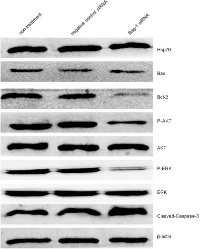 Figure 8 Effects of Bag-1 siRNA and cisplatin on the regulation of various protein expression and activity. A549 cells were grown and infected by Bag-1 or negative control siRNA for 48 hrs and then treated with 5 μg/mL cisplatin for 24 hrs and subjected to Western blot analysis of Hsp70, Bax, Bcl-2, P-AKT, AKT, P-ERK, ERK, and cleaved-Caspase-3.