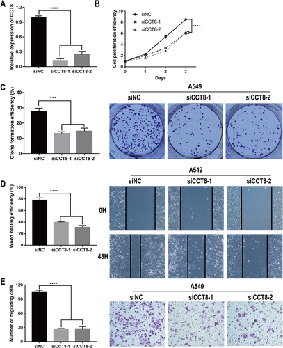 Figure 9 The functional verification of CCT8. (A) qRT-PCR detected the expression level of CCT8. (B and C) CCK-8 assay (B) and colony formation assay (C) showed the cell proliferation. (D and E) The wound healing assay (D) and Transwell assay (E) revealed the cell migration. ***p < 0.001; ****p < 0.0001.