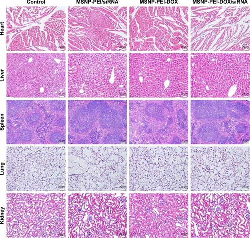 Figure 5 H&E staining of heart, liver, spleen, lung, and kidney; ×200.Abbreviations: DOX, doxorubicin; H&E, hematoxylin and eosin; MDR, multidrug resistance; MSNP, mesoporous silica nanoparticles; PEI, polymerpolyethylenimine.