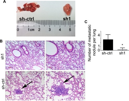 Figure 6 Depletion of INTS8 inhibits lung metastasis in HCC cells.Notes: (A) Gross images of the lungs were obtained following euthanasia of the mice at 8 weeks after surgery. (B) H&E-stained lung sections. The arrows represent metastatic nodules (magnification: 100×, 200×). (C) Number of lung metastasis nodules of the INTS8-knockdown and control groups was calculated (n=5). All data are expressed as means ± SD. *P<0.05, compared with the sh-ctrl group.Abbreviations: HCC, hepatocellular carcinoma; sh1, short hairpin RNA1; sh-ctrl, control short hairpin RNA group.