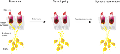 Figure 3. Principle of synaptopathy and synapse regeneration following noise damage. Synaptic connection between peripheral spiral ganglion axons and inner hair cells is lost and leads to synaptopathy with ‘hidden’ hearing loss. Neurotrophic compounds can regenerate ribbon synapses.