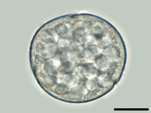 Figure 6. Numerous starch granules in the cytoplast of Rumex species. Scale bar ‒ 10 µm.