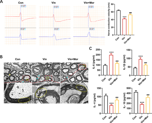 Figure 2 Morin alleviates vincristine-induced sciatic nerve injury. (A) Changes of sciatic nerve conduction velocity in each group. n=6 rats for each group. ***p < 0.001 compared with control group, ###p < 0.001 compared with vincristine group. Upper and down panels represented the action potentials recorded at the near-end and far-end of the sciatic nerve, respectively. (B) Representative images of rat sciatic nerve transmission electron microscope (yellow ↑, ○: myelin sheath, cyan ↑: Schwann cells). (C) Changes in the concentrations of pro-inflammatory factors and anti-inflammatory factors in cerebral cortex of rats in each group. n=6 rats for each group. ***p < 0.001 compared with control group, ###p < 0.001 compared with vincristine group. Data were shown as mean ± SD.