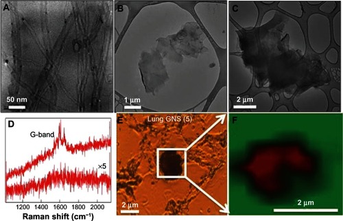 Figure 1 Characterization of carbon-based nanomaterials. Transmission electron micrographs for (A) MWCNT, (B) GNS (2), and (C) GNS (5). (D) Raman spectrum for the carbon-based nanomaterials (top spectrum) exhibits a strong graphitic or G-band ~1590 cm−1 while the animal tissue (bottom spectrum) shows no such signature. (E) Optical micrograph of a typical lung section exposed to GNS (5). (F) Raman G-band map of the boxed area in (E) shows that that the black spots seen in the optical micrograph are indeed carbon nanomaterials.Notes: In the Raman micrograph, red and green colored areas represent a high and no intensities for G-band, respectively. Similar Raman confirmation was obtained for other lung and spleen sections exposed to MWCNT, GNS (2), and GNS (5) (see Supplementary materials for further details).Abbreviations: MWCNT, multiwalled carbon nanotubes; GNS, graphene nanosheets.