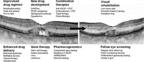 Figure 1 Summary of various strategies used to manage patients with neovascular age-related macular degeneration.