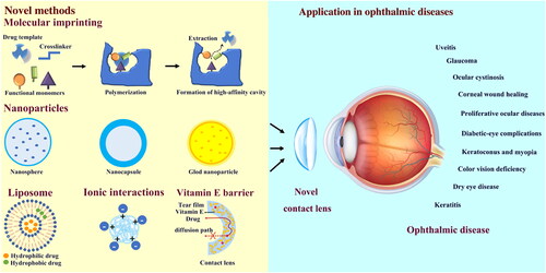 Figure 1. Application of novel contact lenses in ophthalmic diseases.