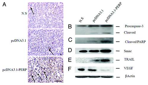Figure 3. PERP induces apoptosis and downregulate VEGF. (A) TUNEL staining of Anip973 xenografts from N.S, Vector and PERP group, respectively. Arrows denote TUNEL positive tumor nuclei. Scale bar represents 100 μm. (B–F) Expression of Caspase 3, PARP, Smac, TRAIL and VEGF by immunoblotting were statistically significant in Anip973 xenografts from N.S, Vector and PERP group, respectively.