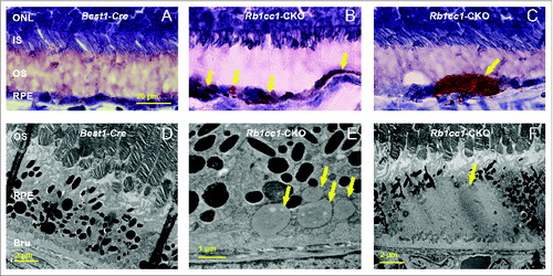 Figure 8. There was increased accumulation of lipid-filled vacuoles within the RPE of the Rb1cc1-CKO mice as compared to littermate controls. (A–C) Sections from eyes of 8-mo-old mice stained with Oil Red O show the disruption of the normal RPE architecture the presence of large, lipid-filled structures (yellow arrows). (D–F) Electron microscopy shows that the lipid is contained within variably sized vacuoles, some of which are large enough to displace the normal RPE melanin content. BRU, Bruch's membrane; IS, inner segment; ONL, outer nuclear layer; OS, outer segment; RPE, retinal pigment epithelium.