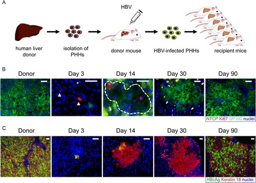 Figure 2. HBV reinfection resistance of proliferating hepatocytes seen in liver-humanized mouse model could be due to NTCP down-regulation. (A) Schematic diagram of the steps used to produce chronically HBV-infected USB mice (first transplantation) and to induce proliferation of HBV-infected human primary hepatocytes through a second transplantation. (B) Immunofluorescent staining of frozen sections for NTCP (green), Ki67(red), SP100 (light blue small dots in the nuclei) and nuclei (blue). SP100 was used to specifically recognize human hepatocytes in the mouse livers. The white triangles in picture of day 3 and broken white line in picture of day 14 depict human hepatocytes. The blue arrow in picture of day 30 depicts proliferating human hepatocytes with normal NTCP expression. The white arrows depict non-cycling human hepatocytes with weak or negative NTCP expression. Green spots seen in the pictures were non-specific. (C) Immunofluorescent staining of frozen sections for HBcAg (green), keratin 18 (red) and nuclei (blue). Keratin 18 was used to specifically recognize human hepatocytes in the mouse livers. Different days represent mice euthanized at different time points post second transplantation as indicated above. Scale bars = 50 μm.