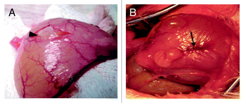 Figure 6. (A) Unseeded PGA scaffold implantation on the rabbit bladder submucosa. Black arrowhead: unseeded PGA scaffold. (B) Detrusor stitched over the PGA scaffold (black arrow).