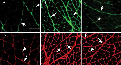 Figure 2. Fluorescence immunostaining for type I (A–C) and type III (D–F) collagen in the rat soleus muscle. In the perimysium (arrow), the expressions of type I and type III collagen in the immobilization (B,E) and muscle contraction groups (C,F) were markedly stronger and thickened, more notably in the immobilization group, compared with the control group. In the endomysium (arrowhead), a higher expression of type I collagen was obvious in the immobilization group (B) compared to the control group (A). However, in the muscle contraction group (C), the expression of type I collagen in the endomysium was similar to the findings in the control group (A). Magniﬁcation 100×, scale bar = 100 µm.