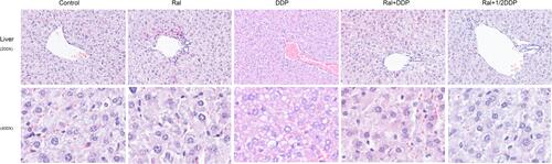 Figure 3 Effect of DDP and Ral on hepatic pathological changes. Liver histology in mice treated with DDP or DDP plus Ral. The major histopathological change induced by DDP in mice liver was hydro-degeneration and microvesicular steatosis. Ral treatment suppressed the DDP-induced alterations, with diminished fatty infiltration and minimal steatosis. H&E-stained sections were observed under a light microscope (200 × and 400 ×).