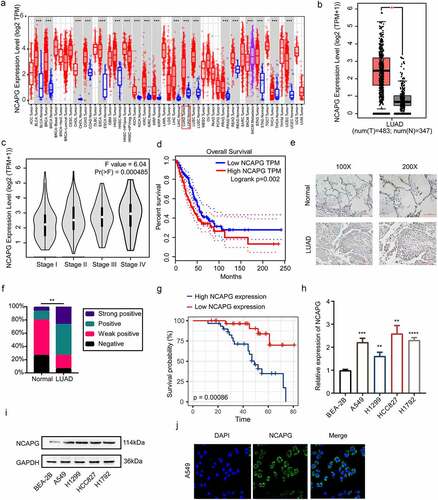 Figure 1. NCAPG was over-expressed in LUAD tissues and cell lines and was associated with patients’ poor prognosis. (a) the mRNA expression level of NCAPG in pan-cancer tissues and corresponding normal specimens by using the TIMER web tool. ***, p < 0.001. (b) the mRNA expression level of NCAPG in LUAD patient tissues (N = 483) and normal samples (N = 347) through GEPIA online tool. *, p < 0.05. (c) NCAPG mRNA levels at different stages of LUAD. (d) the overall survival time of LUAD patients with high or low expression level of NCAPG were analyzed by GEPIA. Logrank p = 0.002. (e) display image of IHC results of NCAPG in LUAD tissue (N = 60) and normal tissue (N = 30). (f) statistical analysis of IHC results in (E). **, p < 0.01. (g) analysis of survival probability of 60 cases of LUAD patients with different NCAPG expression level. p = 0.00086. (h-i) BEA-2B, A549, H1299, HCC827 and H1792 cells were harvested and subjected to Western blotting and RT-PCR analysis. Results presented as Mean ± SD (N = 3). **, p < 0.01, ***, p < 0.001, ****, p < 0.0001. (j) IF was performed to clarify the location of NCAPG in A549 cell. DAPI was used to label the nucleus.