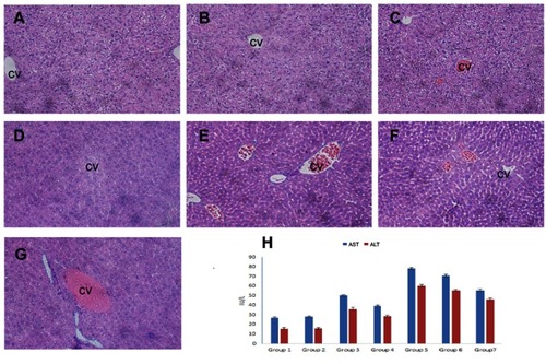 Figure 6 OA alleviates cisplatin-induced hepatotoxicity. Representative sections from mice liver tissue stained by H & E (200× magnification). (A) Control (NS): normal histological structure of the hepatic lobule. (B) Corn oil group: normal hepatic histology with few hydrophobic degenerations of hepatocytes and normal central vein. (C) OA sol+CDDP sol group: mild hydrophobic degeneration of hepatocytes and mild congested central vein. (D) OA-LCC NP and CDDP-LCC NP group: moderate hepatocytes vacuolization. (E, F). CDDP-sol and CDDP-LCC NPs injection group’s, respectively, hepatic necrosis, severe toxicity, congestion and dilatation of the central vein. (G). CDDP/OA-LCC NPs injection group: less toxicity, less vacuolization; (H) oleanolic acid pre-treatment improved liver function and inhibited cisplatin-induced aberrations in ALT, AST levels.Abbreviations: ALS, Alanine Aminotransferase; AST, aspartate aminotransferase; CDDP, cisplatin; OA, oleanolic acid; LCC, lipid coated calcium carbonate; NP, nanoparticles; CV, central vein.