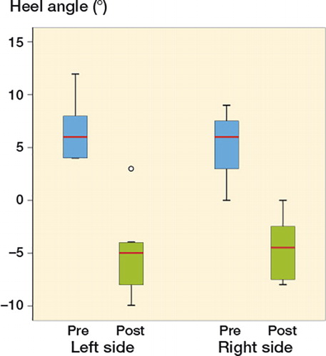 Figure 5. Box plot showing the evolution of the clinical varus deformity after the surgery. The heel angle is reflected at 2 different periods in time, preoperatively (blue) and at final follow-up (green). The results are show by side of foot involvement (please note that positive values in the heel angle line represents varus deformity at the heel, while negative values represent valgus). All the operated feet decreased their varus deformity. The red lines reflect the median heel angle for each group. The bottom of the box represents the 25th percentile and the upper the 75 percentile. The T lines extending from the boxes are the innerfences or whiskers and extend 1.5 the heigth of the box or if no case/row has a value in this range to the minimum and maximum values. The point represents an outlier.